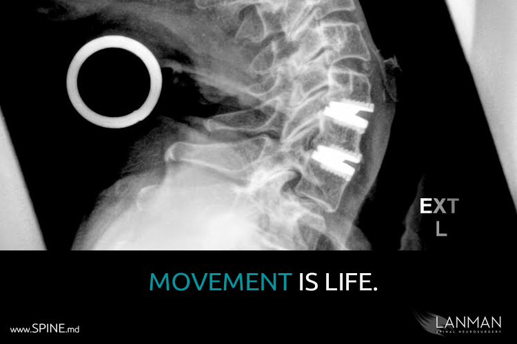 Spine Surgery Xray