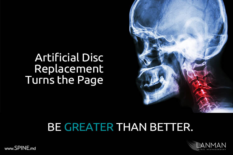 artificial disc replacement