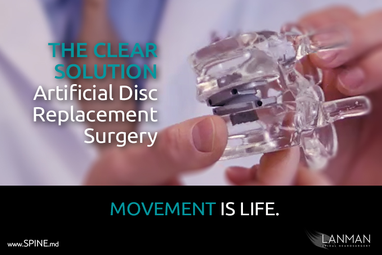 artificial disc replacement