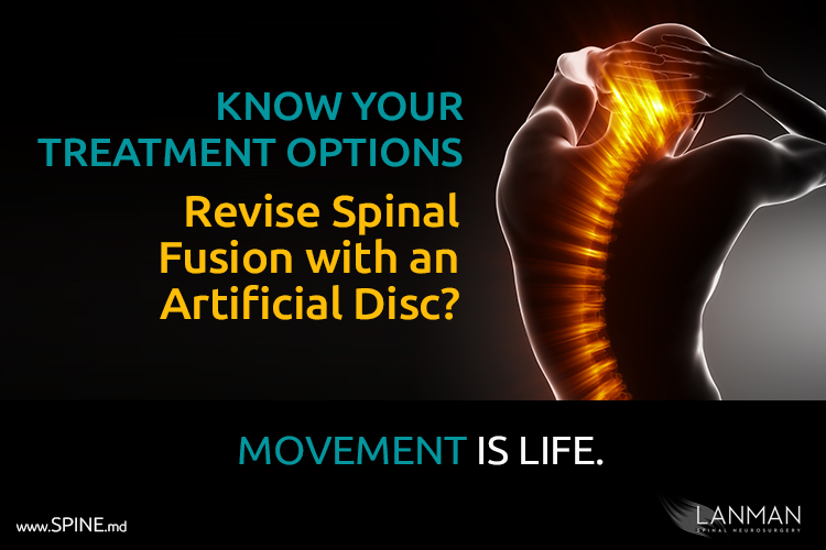 artificial disc replacement surgery