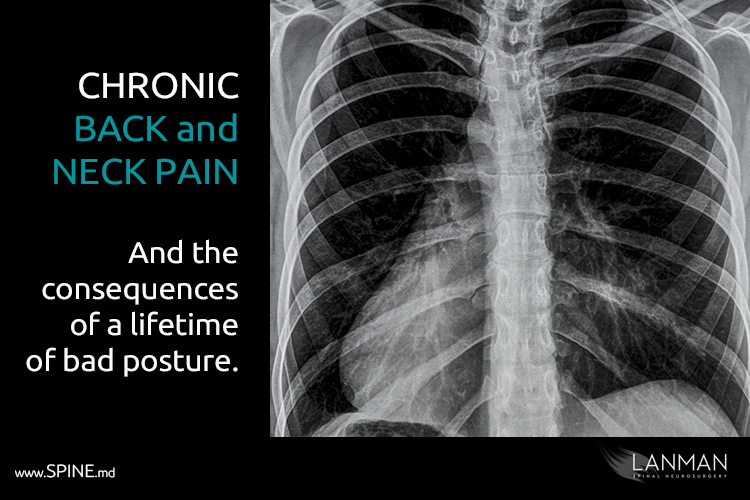 Back and Neck Pain: The consequences of bad posture, bad technology habits.  To protect your spine, the best lessons come from Mom.