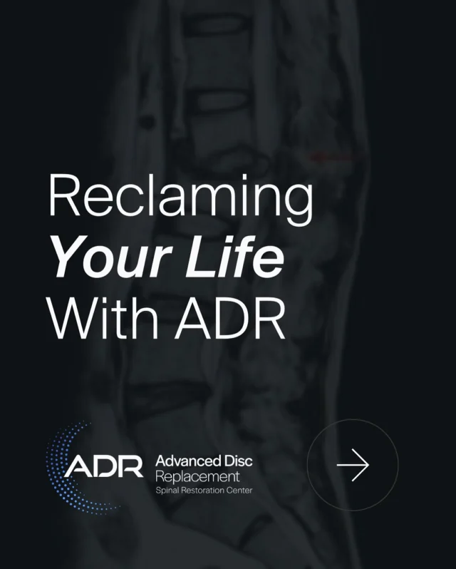 Reverse, Restore, Reclaim…what does that look like in your life?  ADR can reverse the damage of spinal disc degeneration or failed fusions, allowing your spine to restore its function the way nature intended: with motion and flexibility.  After recovery, how you’ll reclaim your life is up to you. Here are some ways ADR can help you rewrite your story.
.
.
.
#ADRSpine #DrToddLanman #LanmanSpinalNeurosurgery  #artificialdiscreplacement #spinehealth #discreplacement #RestortativeMotionSpineSurgery #lumbardiscreplacement #neckpain #backpainrelief #neurosurgeon  #spinecare